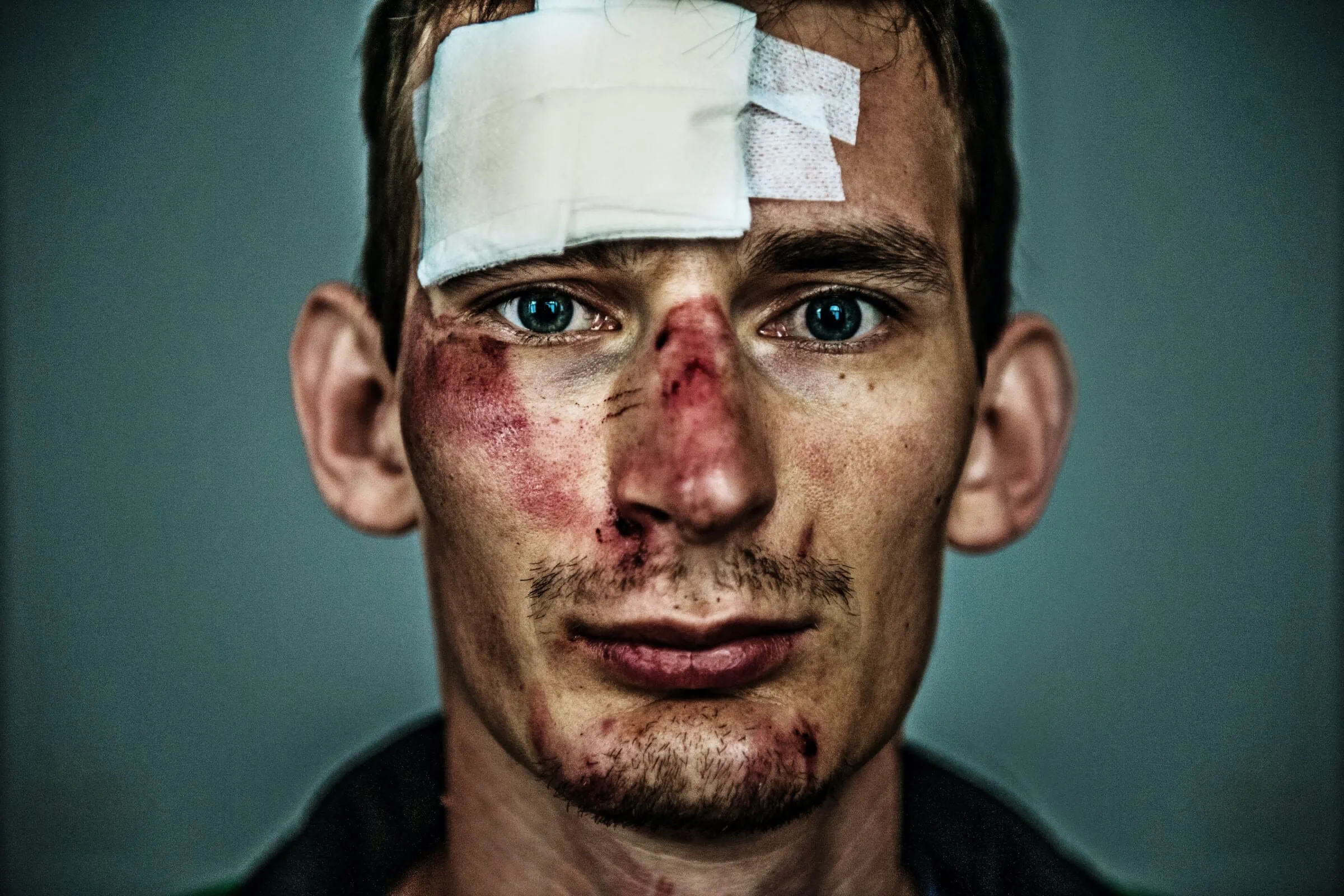 Personal Injury